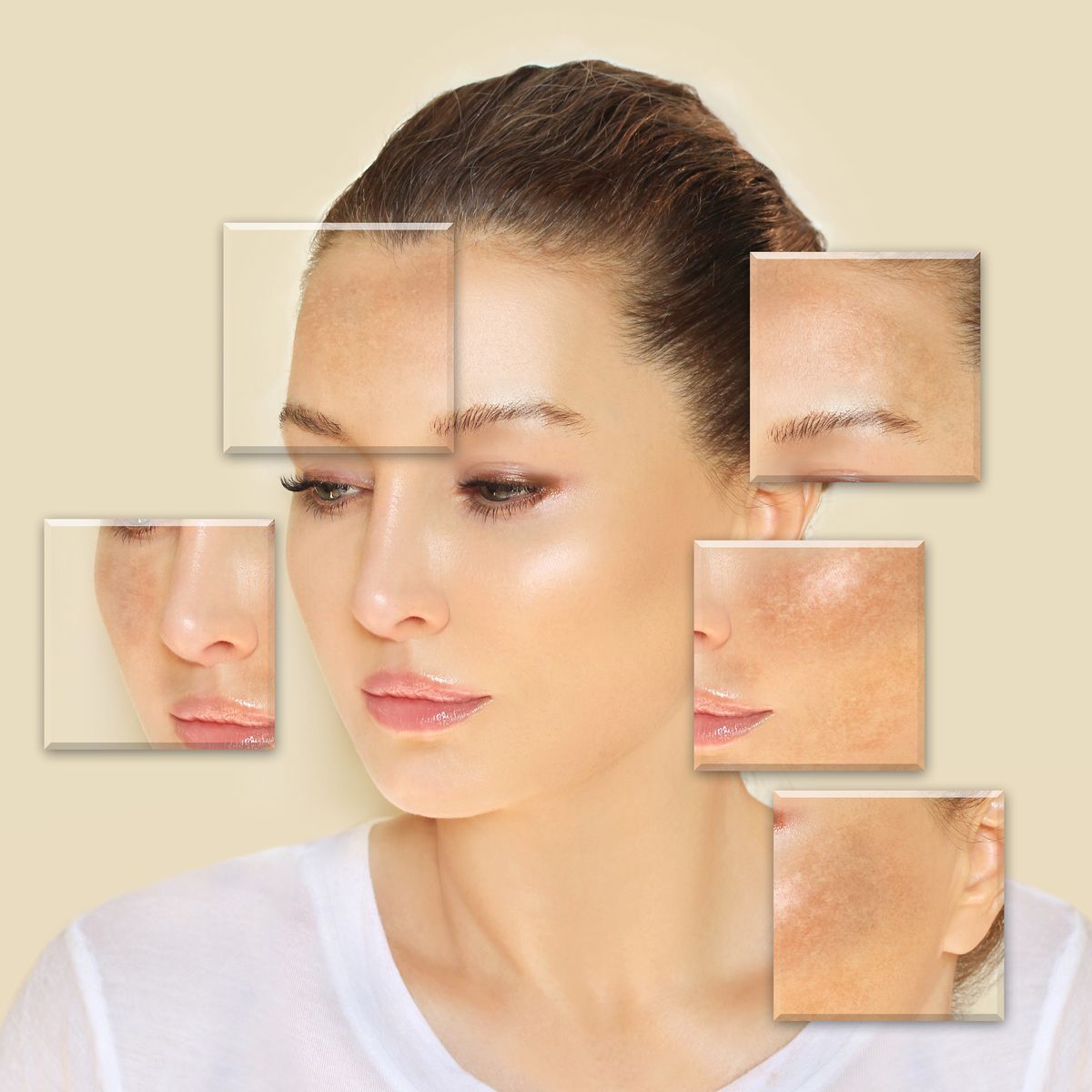 Understanding Hyperpigmentation: Causes, Treatments, and Prevention